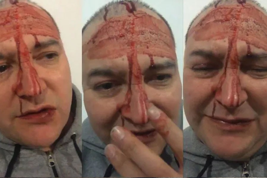 Leo García: la versión policial que duda del ataque homofóbico | Actualidad