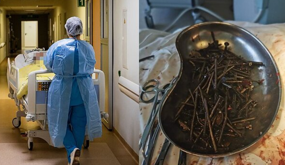 Médicos sacaron más de un kilo de clavos del estómago de un hombre | Internacionales