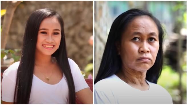 Un raro trastorno genético adelanta el envejecimiento de una chica: "Tengo 16 y parezco de 50 años" | Internacionales