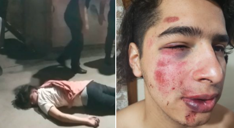 Video: brutal golpiza de patovicas a un joven en la puerta de un boliche en Mendoza | Actualidad