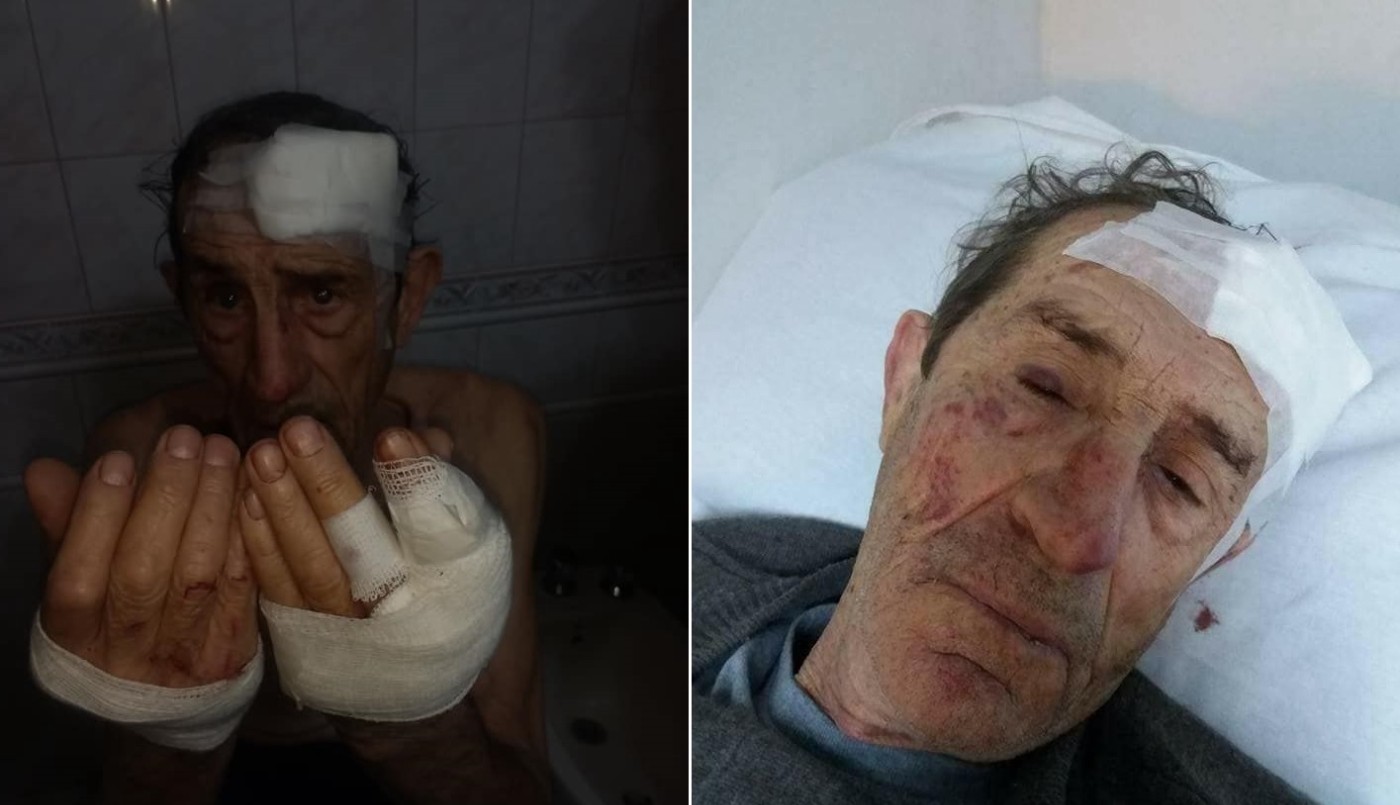 Brutal entradera a un jubilado: "Serrucharon sus manos y sus dedos" | Actualidad