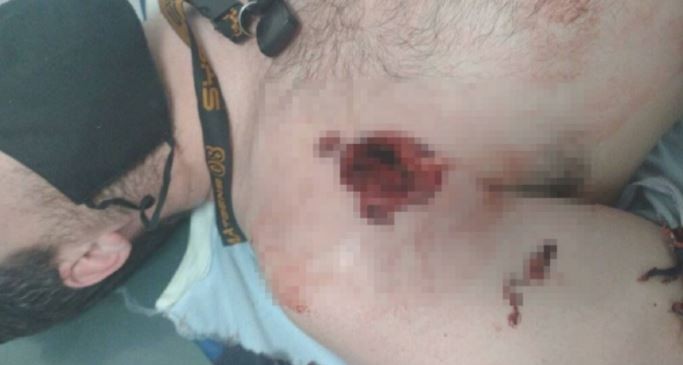 Primera C: un herido y cuatro detenidos tras serios incidentes en el clásico San Martín de Burzaco-Claypole | Deportes