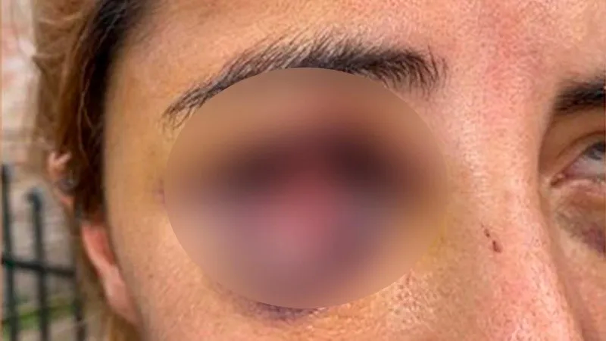 Le dio una brutal paliza a su ex, creyó que la había matado y la escondió abajo de la cama: la salvó su hija de 12 años | Actualidad