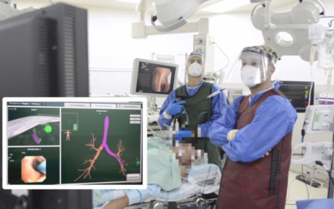 Investigadores israelíes desarrollaron un método de inteligencia artificial para eliminar tumores cancerosos | Internacionales