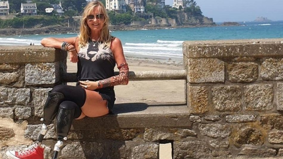 Fue al hospital por una tos y volvió a su casa sin las piernas y un brazo | Internacionales