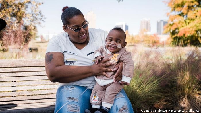 Un bebé nació a los 5 meses de gestación, pesó 420 gramos y sobrevivió: los médicos creen que es un milagro | Internacionales