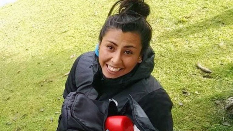 La historia de la chica que se electrocutó en el trabajo y perdió los dos brazos | Actualidad