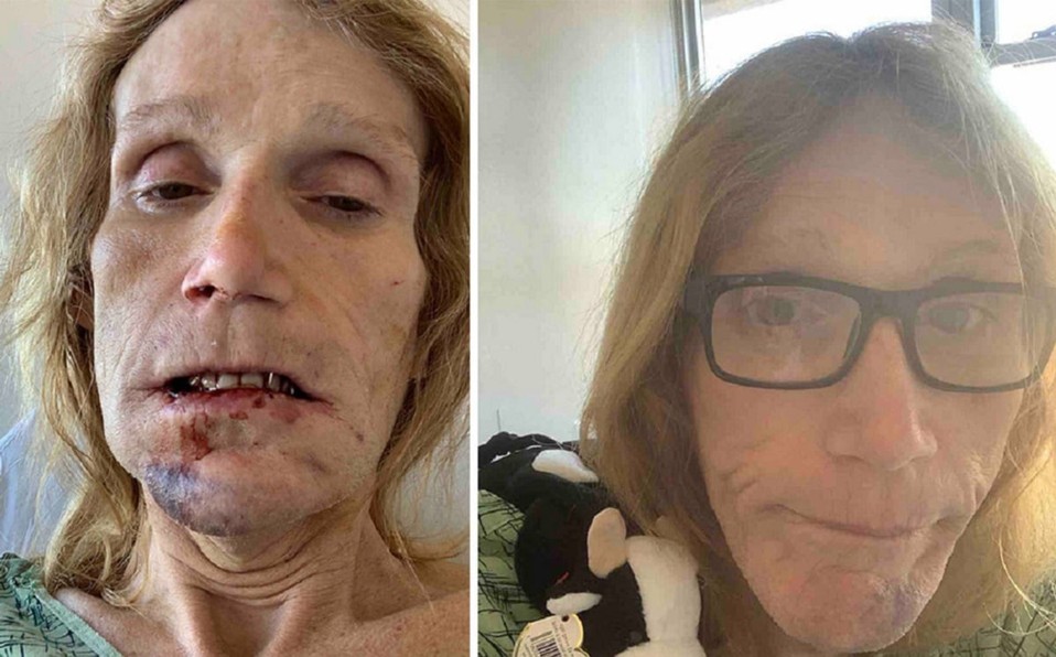 Una mujer trans fue detenida en una cárcel de hombres: le rompieron la mandíbula y tardaron 12 horas en atenderla | Internacionales