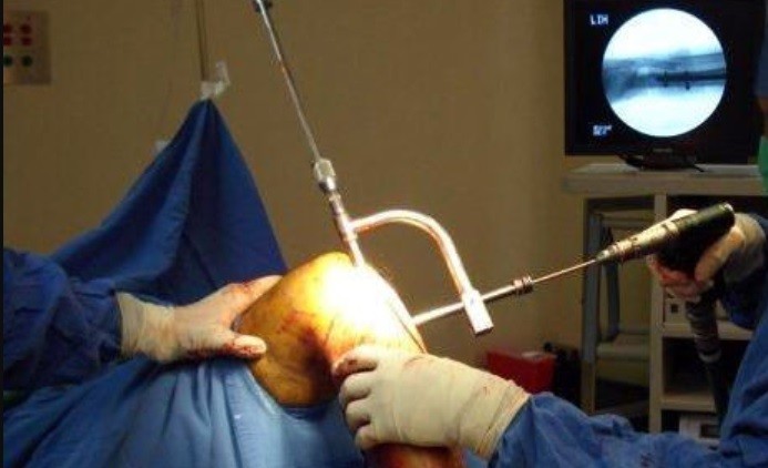 Condenaron a una cirujana tras amputarle a un paciente la pierna equivocada | Internacionales