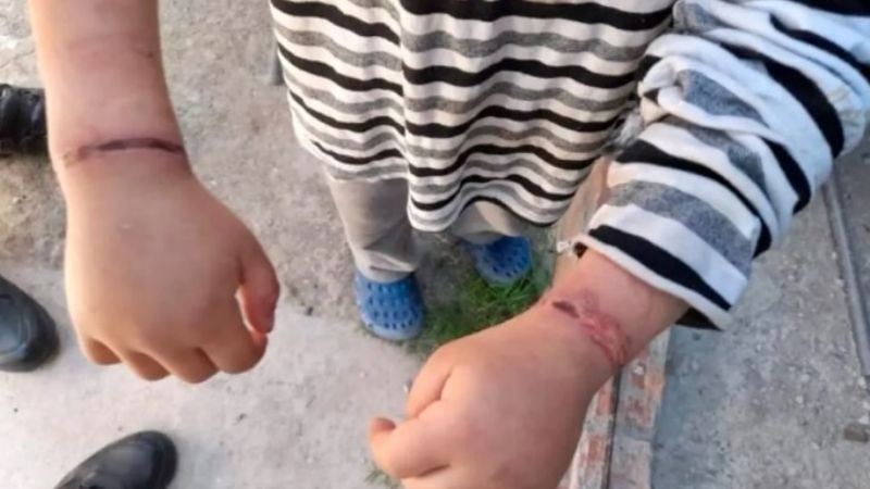 Rescataron a un nene de 6 años que había sido atado con alambre por su mamá | Actualidad