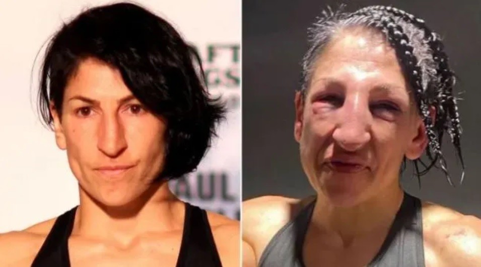 La foto del antes y el después: boxeadora recibió 236 golpes | Deportes