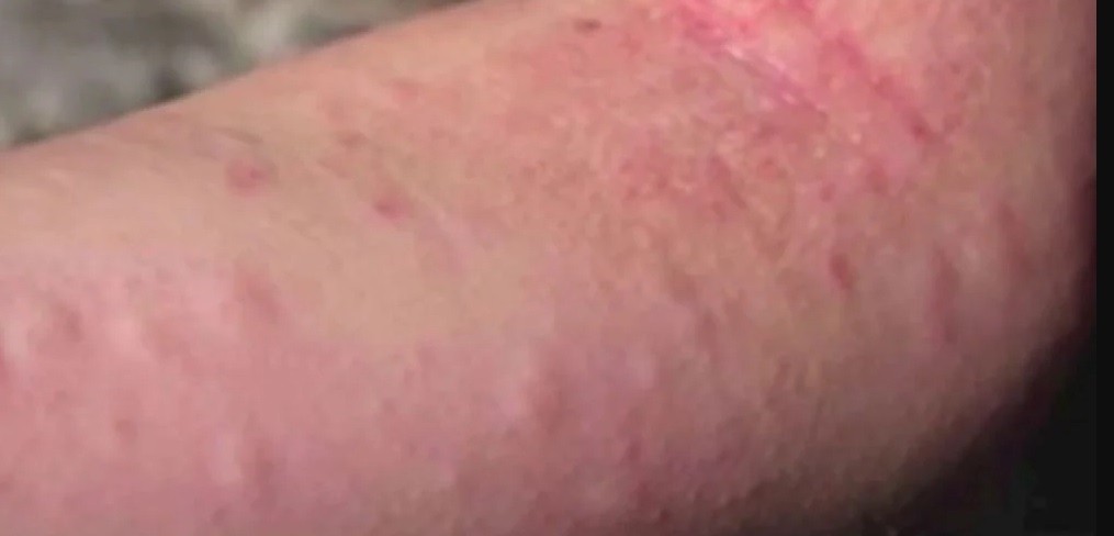 "Estoy en el fin del mundo", dijo la hija de turista muerto tras ataque de abejas en Córdoba | Actualidad