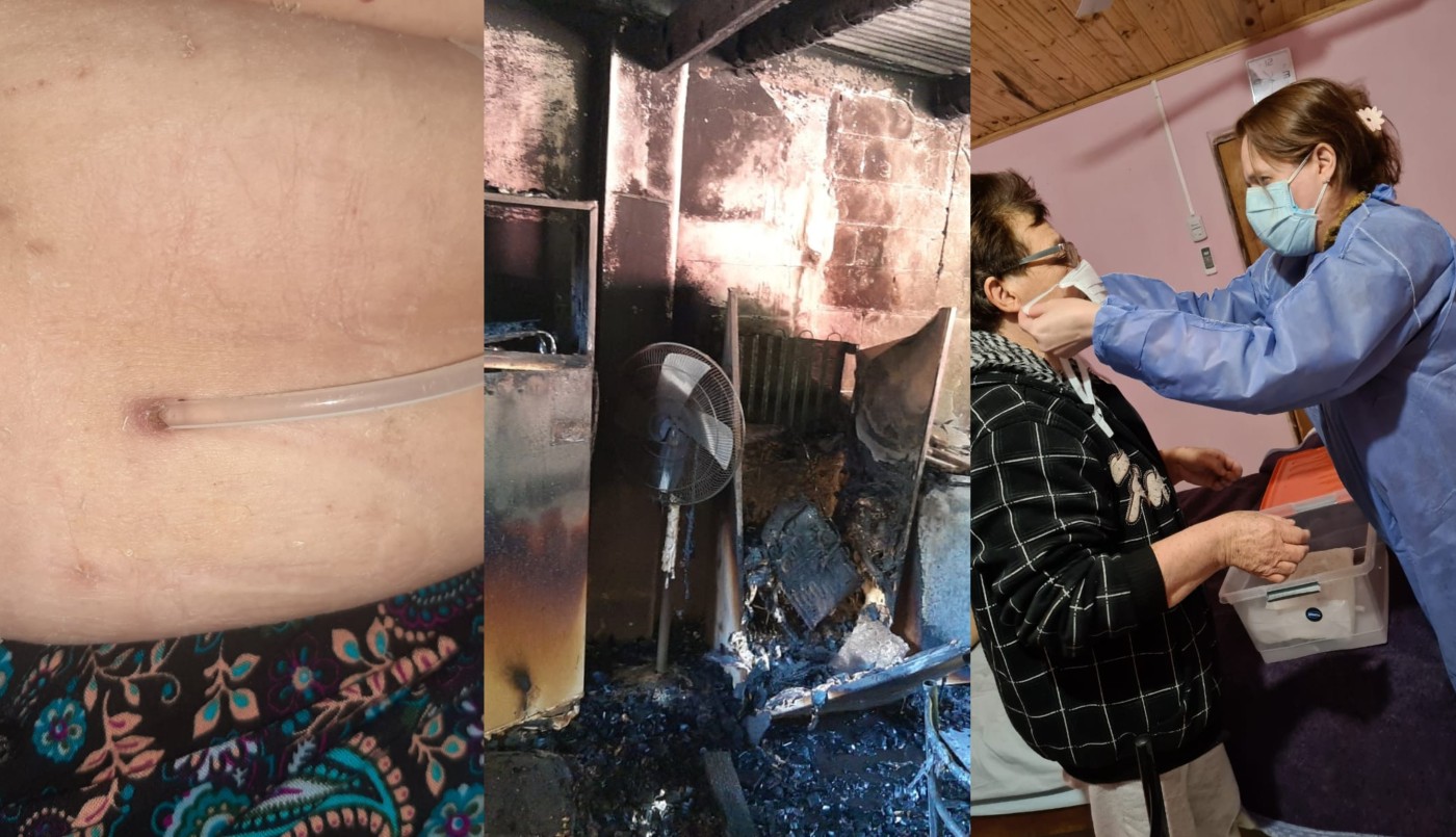 Francisca tiene 65 años, sufre insuficiencia renal, un feroz incendio destrozó por completo su casa y pide ayuda | Actualidad