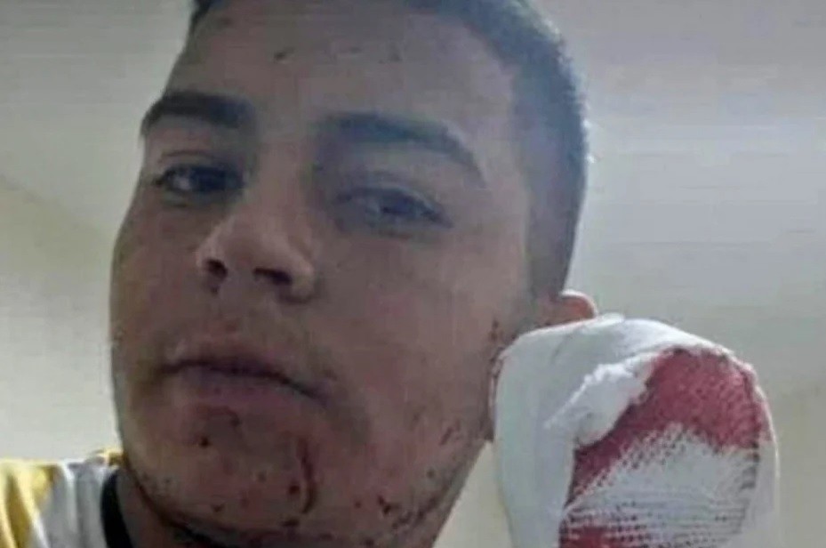 Brutal asalto con un machete a un repartidor de comida: perdió cuatro dedos | Actualidad