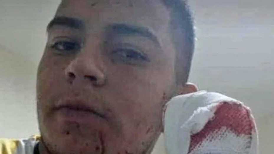 Dictaron prisión preventiva para el acusado de cortarle cuatro dedos a un delivery | Actualidad