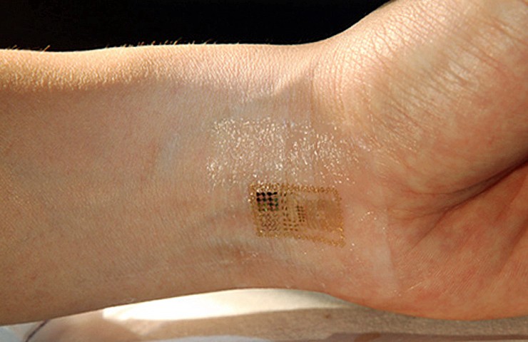 Una empresa belga implanta un "chip" de identificación bajo la piel sus empleados | Tecno