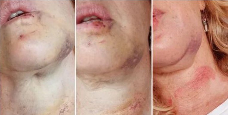 Alarma por un hombre que agrede a mujeres en la calle en Belgrano R. | Actualidad