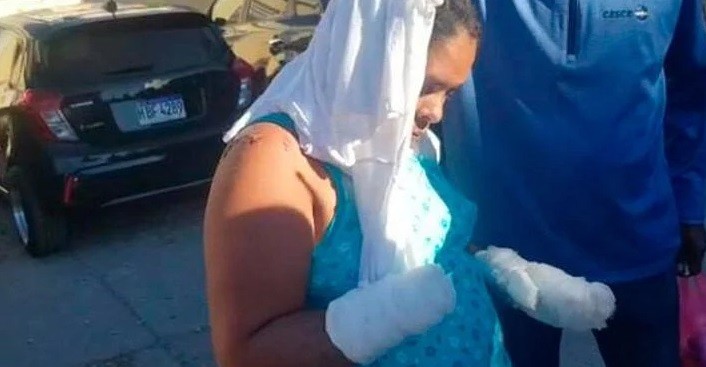 Con un machete, le cortó las manos a una mujer casada que no quería salir con él | Internacionales