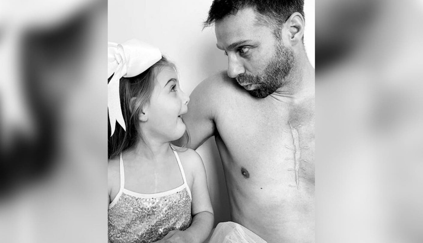 Papá se tatuó la cicatriz que tiene su hija de 4 años en el pecho por una cirugía a corazón abierto | Internacionales