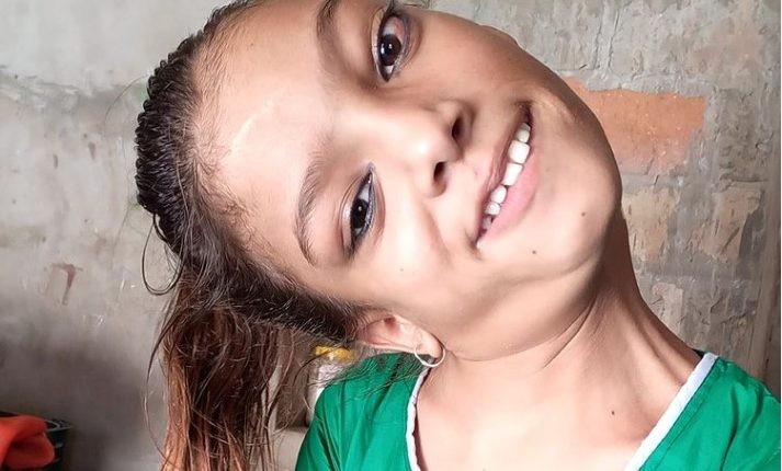 La “nueva vida” que tendrá una chica que estuvo 13 años con la cabeza en un ángulo de 90 grados | Internacionales