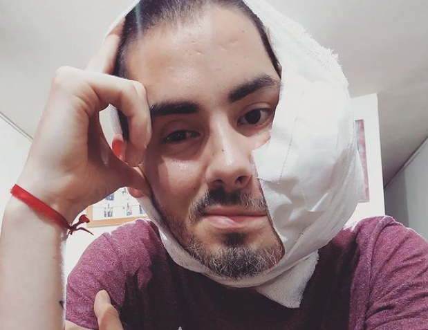 "Él ya no sufre más": falleció Sebastián, el joven que tenía un tumor en la cara | Actualidad