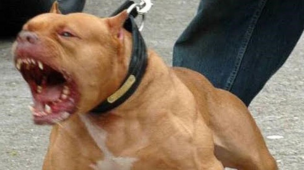 Se peleaban los perros pitbull de su novio, quiso separarlos y terminó internada con graves heridas | Actualidad