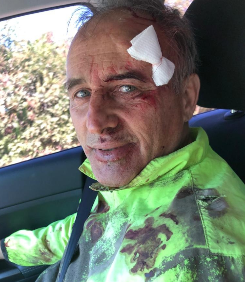 Se accidentó en bici el diputado nacional Baldassi | Actualidad