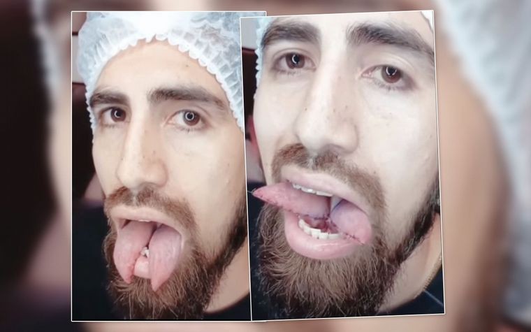 El ex jugador de Boca que se hizo una lengua bífida para parecer una serpiente | Actualidad