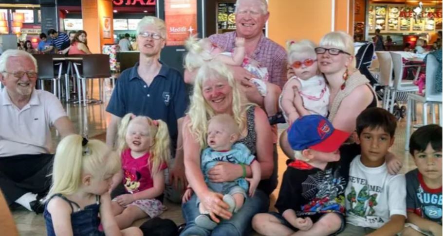 Presentan un proyecto de ley de asistencia integral a personas con albinismo en CABA | Actualidad