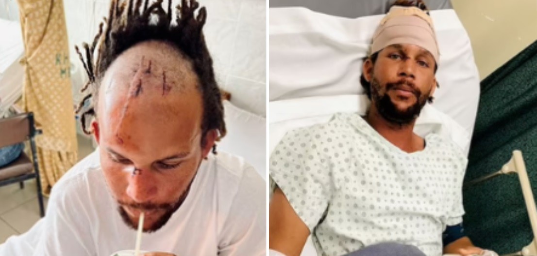 "Le abrí la boca, saqué mis dedos y cayó": un cocodrilo le atrapó la cabeza cuando pescaba bajo el agua | Internacionales