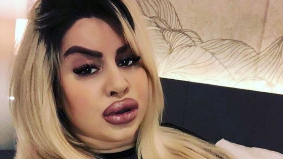 Se hizo 5 cirugías, gastó 150.000 dólares para tener la cola más grande del mundo y la rompe en OnlyFans | Redes