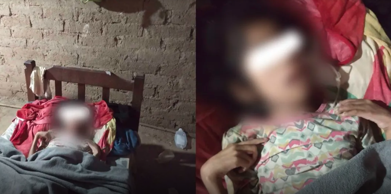 La nena de 12 años que quedó huérfana y vive en condiciones extremas: no come y los chanchos le comieron los dedos | Actualidad