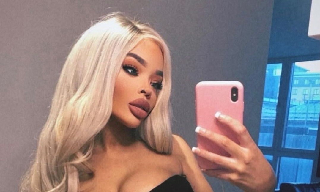 Para parecerse a un filtro de Instagram, gastó 20.000 euros en cirugías | Internacionales