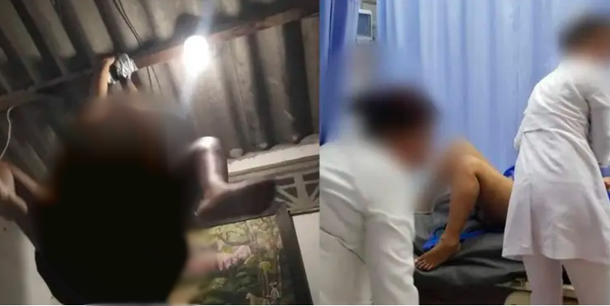 Mujer intentó realizar un famoso reto sexual de la araña y terminó en el hospital | Internacionales
