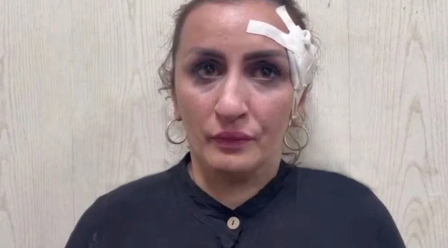 Detuvieron a la mujer que vendió a su bebé recién nacido para pagarse la operación de nariz | Internacionales