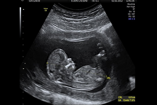 Asaltaron a una policía embarazada y se llevaron hasta la ecografía | Actualidad