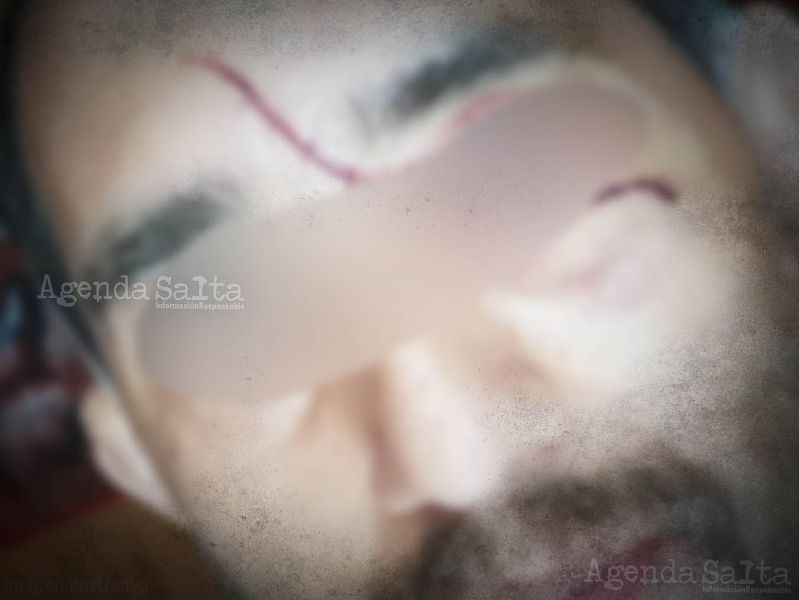 Una mujer le cortó la cara a su ex pareja con un cuchillo porque inició una nueva relación | Actualidad