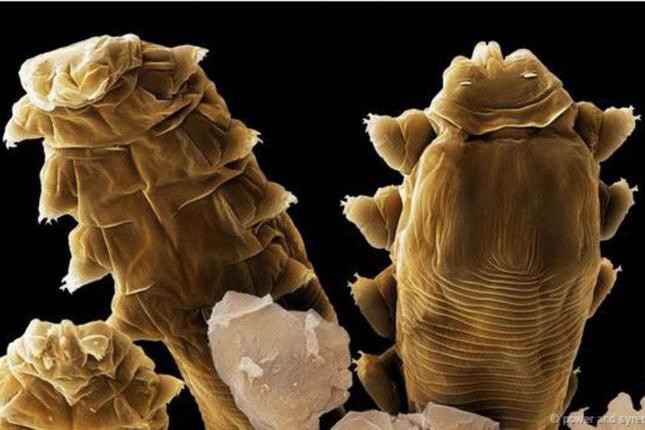 Los ácaros microscópicos que viven en nuestra cara | Curiosidades