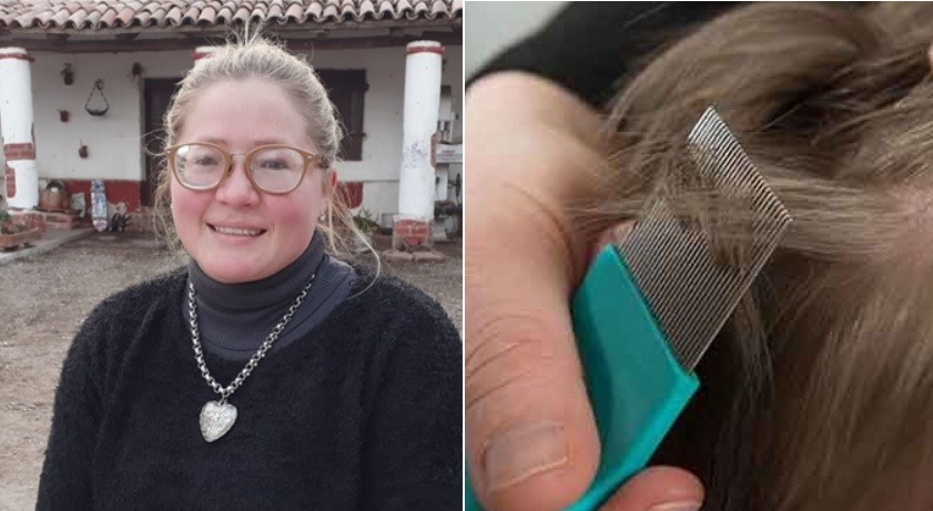 Trabaja medio día y para completar sus ingresos se ofrece como "sacadora de piojos" | Actualidad