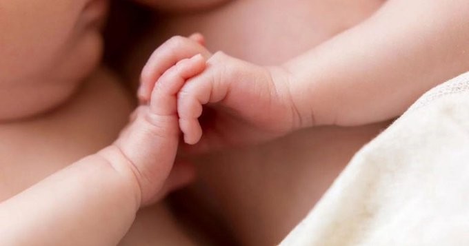 Nacieron bebas siamesas en Córdoba: "Están estables" | Actualidad