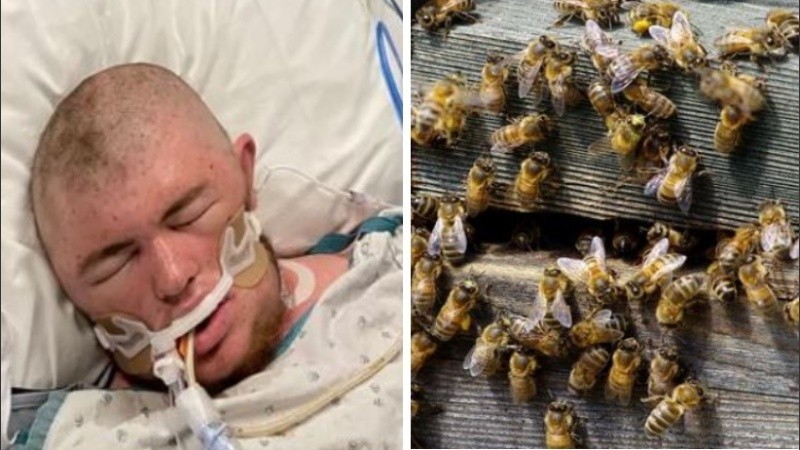 Sobrevivió de milagro tras ser picado 20 mil veces por abejas asesinas africanas | Internacionales