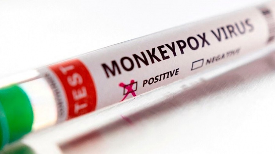 Viruela del mono en Argentina: confirmaron otros 265 casos, un 20% más que la semana anterior | Actualidad