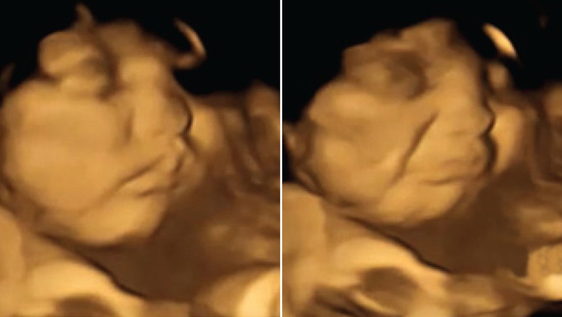 "Sorprendente": muestran la reacción de los bebés al sentir olores y sabores en el útero | Internacionales