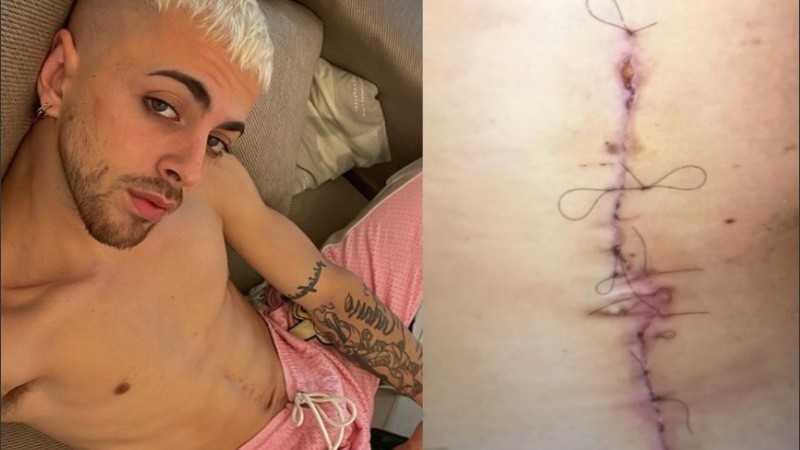 La llamativa cicatriz de J Rei en el abdomen | Espectáculos