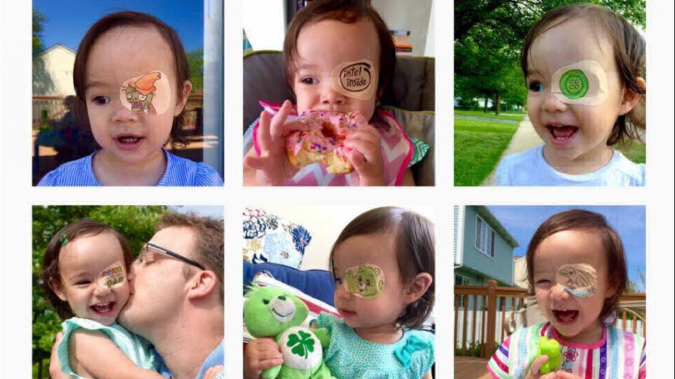 Una papá le dibuja el parche del ojo a su hija para que se recupere con alegría | Curiosidades