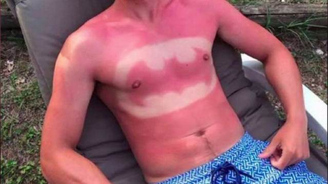 #EsViral: dermatólogos alertan sobre los riesgos de la moda de los tatuajes solares en EEUU | Curiosidades