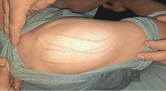 Un policía denunció que fue atacado por un espíritu maligno: fue internado en una sala de Salud Mental | Actualidad