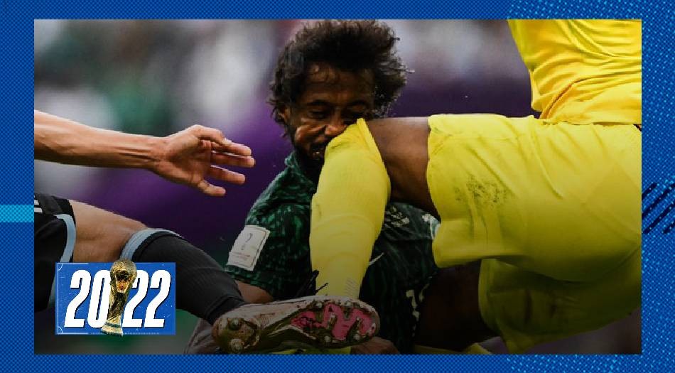 Afuera del Mundial: Al Shahrani sufrió fractura de mandíbula y fue operado | Qatar 2022