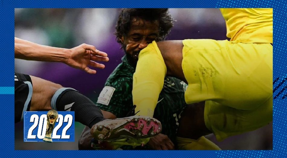 Fractura de mandíbula y cráneo, la terrible lesión del defensor de Arabia Saudita | Qatar 2022