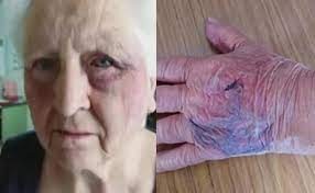 Asaltaron y golpearon a una pareja de jubilados y ahora se quieren ir de su casa | Actualidad